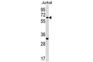 SMARCD1 Antibody (C-term) western blot analysis in Jurkat cell line lysates (35µg/lane). (SMARCD1 antibody  (C-Term))