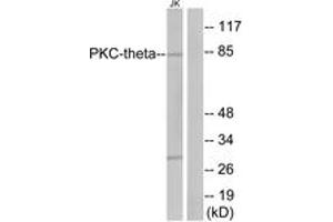 Western blot analysis of extracts from Jurkat cells, treated with PMA 200nM 30', using PKC thet (Ab-676) Antibody. (PKC theta antibody  (AA 643-692))