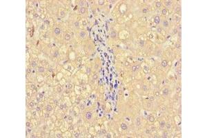 Immunohistochemistry of paraffin-embedded human liver tissue using ABIN7143790 at dilution of 1:100 (alpha 2 Macroglobulin antibody  (AA 1216-1467))