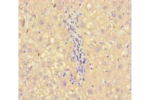 Immunohistochemistry of paraffin-embedded human liver tissue using ABIN7143790 at dilution of 1:100