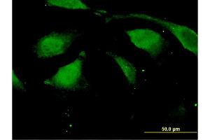 Immunofluorescence of monoclonal antibody to DAZAP2 on HeLa cell. (DAZAP2 antibody  (AA 93-168))