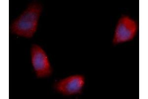 Immunofluorescence (IF) image for anti-Fibroblast Growth Factor 12 (FGF12) (AA 1-181) antibody (PE) (ABIN5565468) (FGF12 antibody  (AA 1-181) (PE))