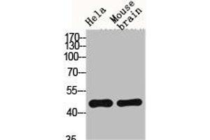 Western Blot analysis of HELA MOUSE-BRAIN cells using Fusin Polyclonal Antibody (CXCR4 antibody  (C-Term))