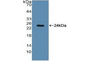 WB of Protein Standard: different control antibodies against Highly purified E. (Nucleolin ELISA Kit)