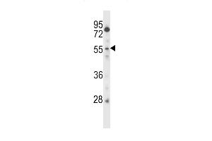 CSRNP2 Antibody (C-term) (ABIN657400 and ABIN2846440) western blot analysis in CEM cell line lysates (35 μg/lane).