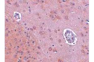 Immunohistochemical staining of rat brain tissue with 2. (FAM120A antibody  (Internal Region))
