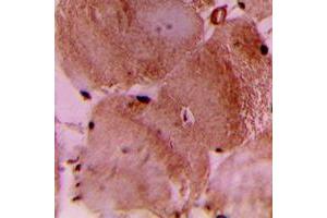Immunohistochemical analysis of cTnI staining in human heart formalin fixed paraffin embedded tissue section. (TNNI3 antibody  (N-Term))