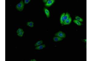 Immunofluorescence staining of HepG2 cells with ABIN7169938 at 1:100, counter-stained with DAPI. (SCN4B antibody  (AA 31-162))