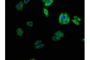 Immunofluorescence (IF) image for anti-Sodium Channel, Voltage-Gated, Type IV, beta Subunit (SCN4B) (AA 31-162) antibody (ABIN7169938)