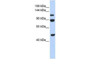 NARG1L antibody used at 1 ug/ml to detect target protein. (NARG1L antibody  (Middle Region))