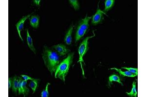 Immunofluorescent analysis of Hela cells using ABIN7147035 at dilution of 1:100 and Alexa Fluor 488-congugated AffiniPure Goat Anti-Rabbit IgG(H+L) (CATSPER4 antibody  (AA 306-472))