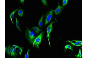 Immunofluorescent analysis of Hela cells using ABIN7147035 at dilution of 1:100 and Alexa Fluor 488-congugated AffiniPure Goat Anti-Rabbit IgG(H+L)