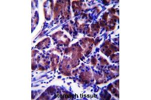 Immunohistochemistry (IHC) image for anti-Lysophospholipase Protein 1 (LYPL1) antibody (ABIN2997640) (LYPL1 antibody)