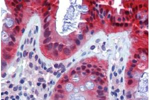 Human Colon (formalin-fixed, paraffin-embedded) stained with CASP7 antibody ABIN462356 followed by biotinylated anti-mouse IgG secondary antibody ABIN481714, alkaline phosphatase-streptavidin and chromogen. (Caspase 7 antibody)