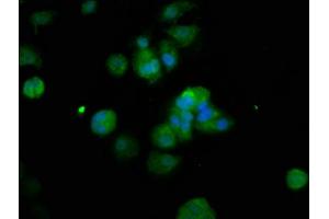 Immunofluorescence staining of MCF-7 cells with ABIN7150380 at 1:200, counter-stained with DAPI. (RFX2 antibody  (AA 1-130))