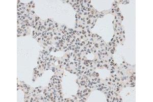 Immunohistochemistry of paraffin-embedded Rat lung using ZNF148 Polyclonal Antibody at dilution of 1:100 (40x lens). (ZNF148 antibody)