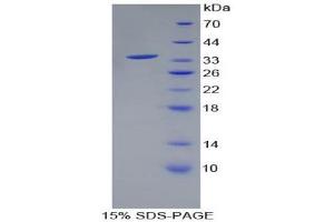 SDS-PAGE (SDS) image for Hydroxysteroid (17-Beta) Dehydrogenase 1 (HSD17B1) (AA 4-289) protein (His tag) (ABIN2123868)