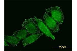 Immunofluorescence of monoclonal antibody to IL1B on HeLa cell. (IL-1 beta antibody  (AA 1-269))
