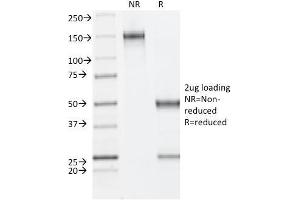 SDS-PAGE Analysis Purified ER-beta Mouse Monoclonal Antibody (ESR2/686). (ESR2 antibody  (C-Term))