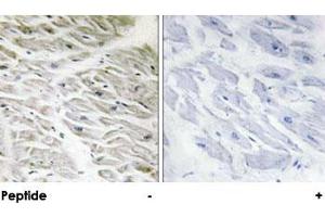 Immunohistochemical analysis of paraffin-embedded human heart tissue using PPP1R14A polyclonal antibody .