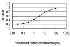 Detection limit for recombinant GST tagged FBXL10 is approximately 0. (KDM2B antibody  (AA 457-555))