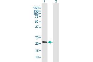 Western Blot analysis of FKBP11 expression in transfected 293T cell line by FKBP11 MaxPab polyclonal antibody.