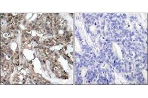 Immunohistochemistry (IHC) image for anti-V-Akt Murine Thymoma Viral Oncogene Homolog 1/2 (AKT1/2) (AA 276-325) antibody (ABIN2888943) (AKT1/2 antibody  (AA 276-325))