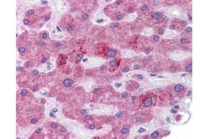 HGF antibody was used for immunohistochemistry at a concentration of 4-8 ug/ml. (HGF antibody)