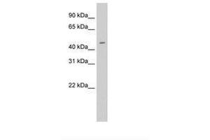 Image no. 2 for anti-E74-Like Factor 3 (Ets Domain Transcription Factor, Epithelial-Specific) (ELF3) (N-Term) antibody (ABIN6736320) (ELF3 antibody  (N-Term))