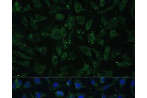 Immunofluorescence analysis of L929 cells using APH1A Polyclonal Antibody at dilution of 1:100 (40x lens). (APH1A antibody)