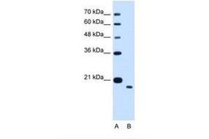 Image no. 1 for anti-Transmembrane Protein 91 (TMEM91) (AA 51-100) antibody (ABIN341306) (TMEM91 antibody  (AA 51-100))