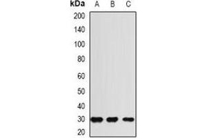 Western blot analysis of RGR expression in HEK293T (A), mouse liver (B), rat heart (C) whole cell lysates. (RGR antibody)