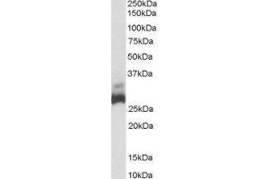 Western Blotting (WB) image for Succinate Dehydrogenase Complex, Subunit B, Iron Sulfur (Ip) (SDHB) peptide (ABIN368813)
