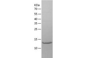 Western Blotting (WB) image for WASH Complex Subunit 4 (WASHC4) (AA 760-918) protein (His tag) (ABIN7287410) (WASH Complex Subunit 4 (WASHC4) (AA 760-918) protein (His tag))