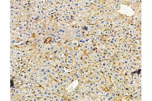 anti-Chordin-Like 1 (CHRDL1) antibody