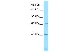 Western Blotting (WB) image for anti-Latent Transforming Growth Factor beta Binding Protein 4 (LTBP4) (C-Term) antibody (ABIN2789916) (LTBP4 antibody  (C-Term))