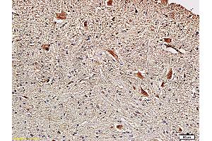 Formalin-fixed and paraffin embedded rat brainstem with Anti-Fascin1 Polyclonal Antibody, Unconjugated (ABIN728293) at 1:300, followed by conjugation to the secondary antibody and DAB staining (Fascin antibody  (AA 11-110))