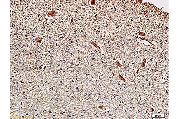 Fascin antibody  (AA 11-110)