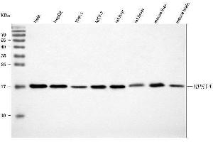 Western blot analysis of RPS14 using anti-RPS14 antibody (ABIN7599005).