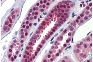 Human Kidney (formalin-fixed, paraffin-embedded) stained with NFX1 antibody ABIN462262 followed by biotinylated goat anti-rabbit IgG secondary antibody ABIN481713, alkaline phosphatase-streptavidin and chromogen. (NFX1 antibody  (C-Term))