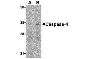 Western Blotting (WB) image for anti-Caspase 4, Apoptosis-Related Cysteine Peptidase (CASP4) (N-Term) antibody (ABIN2477914) (Caspase 4 antibody  (N-Term))