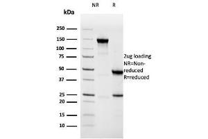 SDS-PAGE Analysis Purified Napsin A Mouse Monoclonal Antibody (NAPSA/3308). (NAPSA antibody  (AA 189-299))