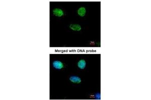 ICC/IF Image Immunofluorescence analysis of paraformaldehyde-fixed HeLa, using MCM3, antibody at 1:500 dilution. (MCM3 antibody)