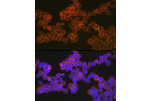 Immunofluorescence analysis of Jurkat cells using CD5 Rabbit mAb (ABIN7266206) at dilution of 1:100 (40x lens).