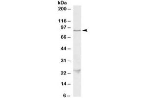 Western blot testing of HeLa lysate with TBK1 antibody at 1ug/ml. (TBK1 antibody)