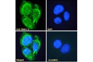 ABIN335150 Immunofluorescence analysis of paraformaldehyde fixed U2OS cells, permeabilized with 0. (Netrin 1 antibody  (C-Term))