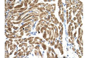 PEX10 antibody was used for immunohistochemistry at a concentration of 4-8 ug/ml to stain Skeletal muscle cells (arrows) in Human Muscle. (PEX10 antibody  (Middle Region))