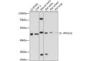 Western blot analysis of extracts of various cell lines, using PPHLN1 antibody (ABIN7269229) at 1:1000 dilution. (PPHLN1 antibody  (AA 195-255))