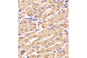 Immunohistochemical analysis of paraffin-embedded H. (Glutathione Synthetase antibody  (C-Term))