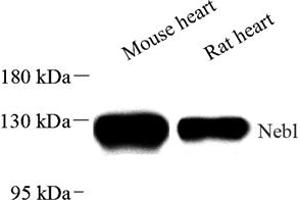 Western blot analysis of Nebulette (ABIN7074788) at dilution of 1: 2000 (Nebulette antibody)